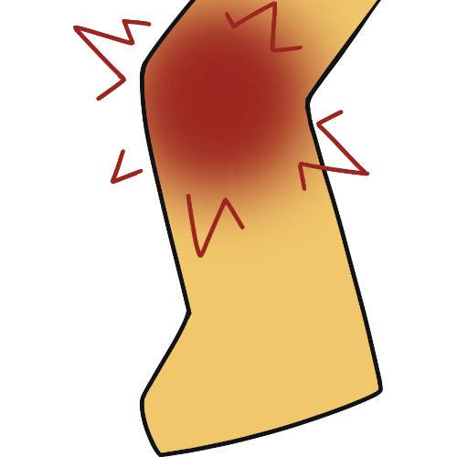 knee pain