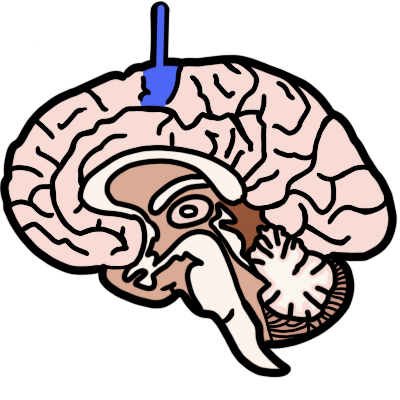 precentral gyrus