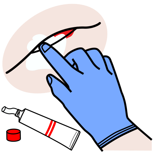 apply cream on injury