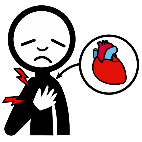 tachycardia
