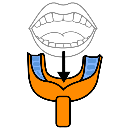 take dental impression