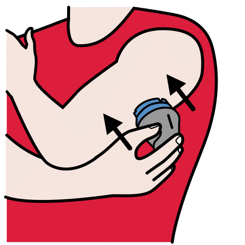 poner sensor de glucosa