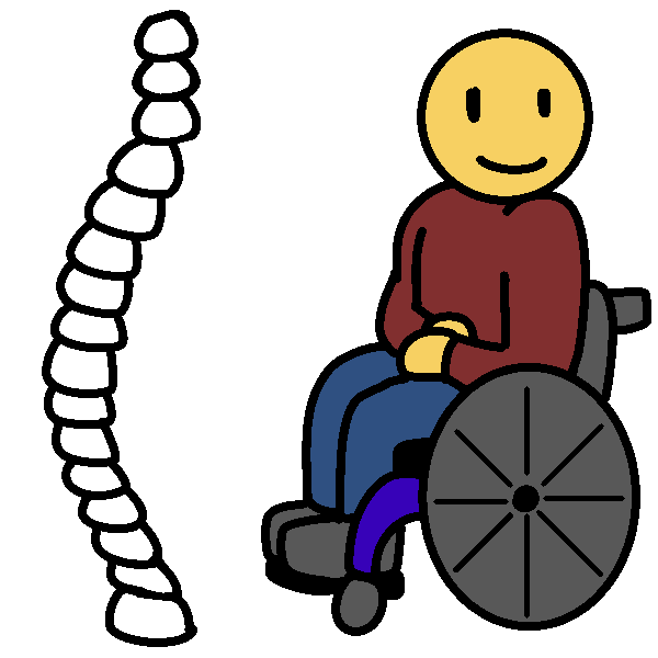 adult (idiopathic) scoliosis
