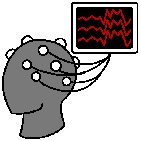 EEG (electroencephalogram)