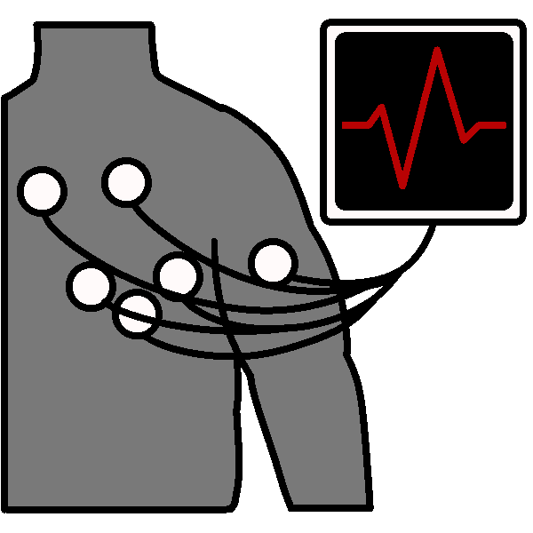 EKG/ECG (electrocardiogram)