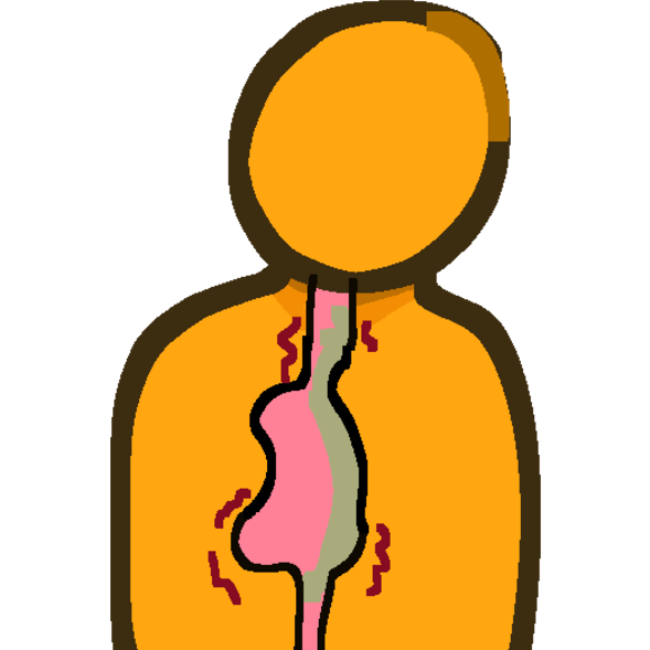 acid reflux