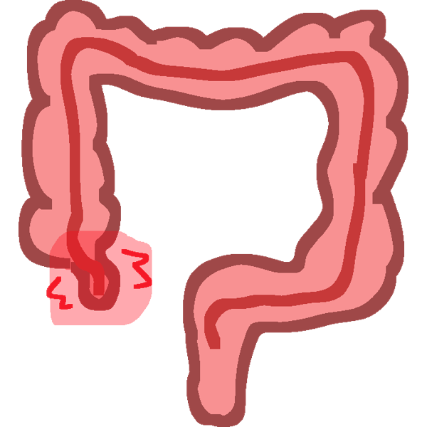 appendicitis