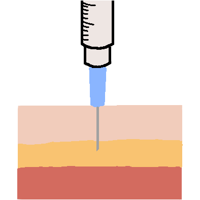 subcutaneous injection - 90 degree